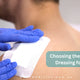 Choose the Right Sterile Dressing for Wounds